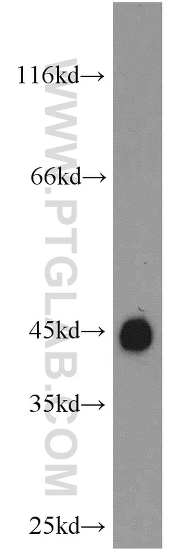 GAP43 Antibody in Western Blot (WB)