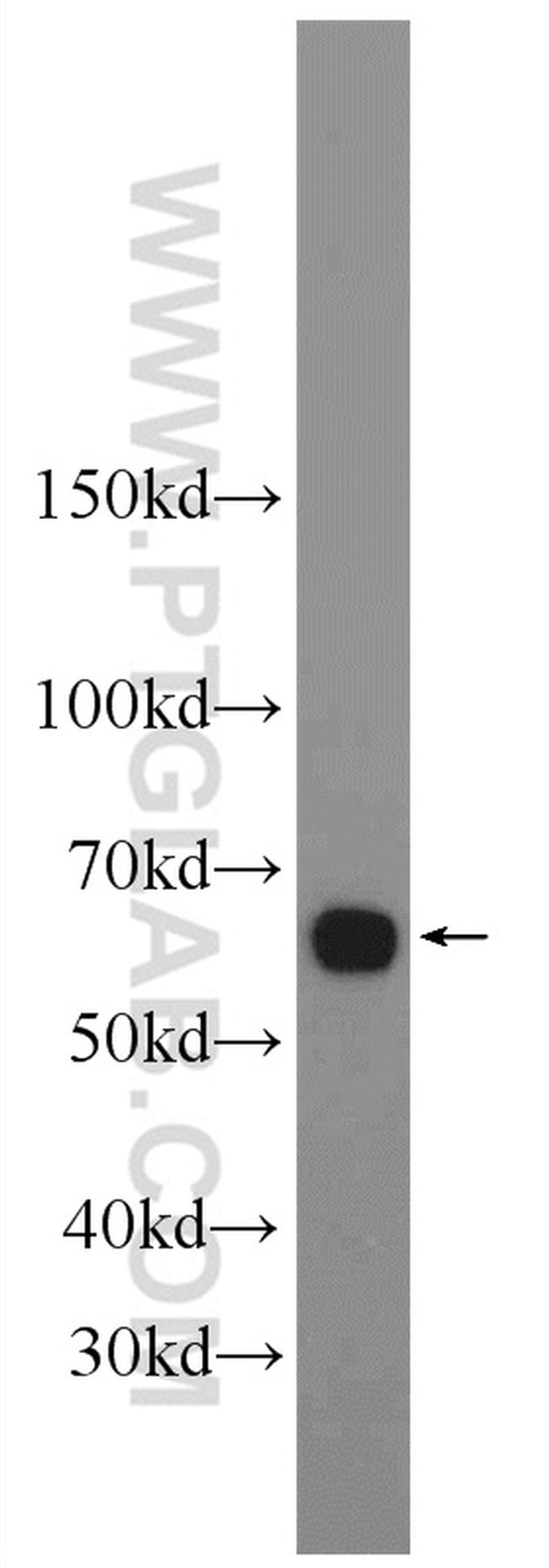 Frizzled 7 Antibody in Western Blot (WB)