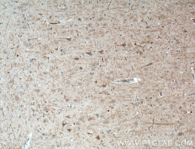 LRRTM4 Antibody in Immunohistochemistry (Paraffin) (IHC (P))