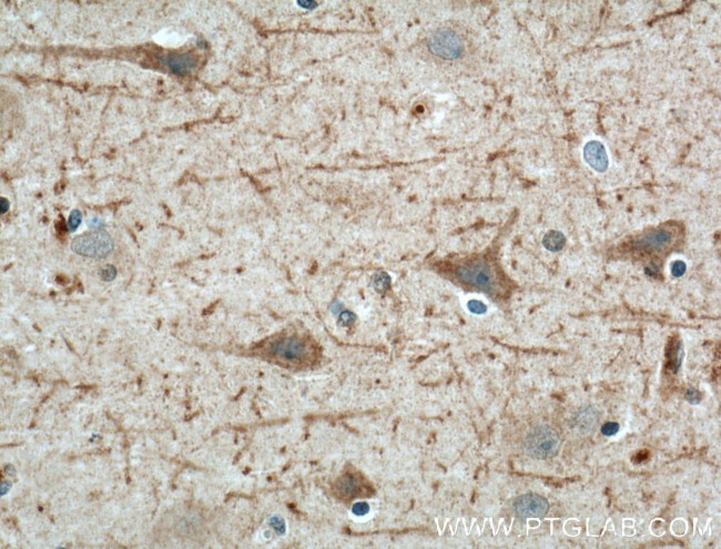 LRRTM4 Antibody in Immunohistochemistry (Paraffin) (IHC (P))