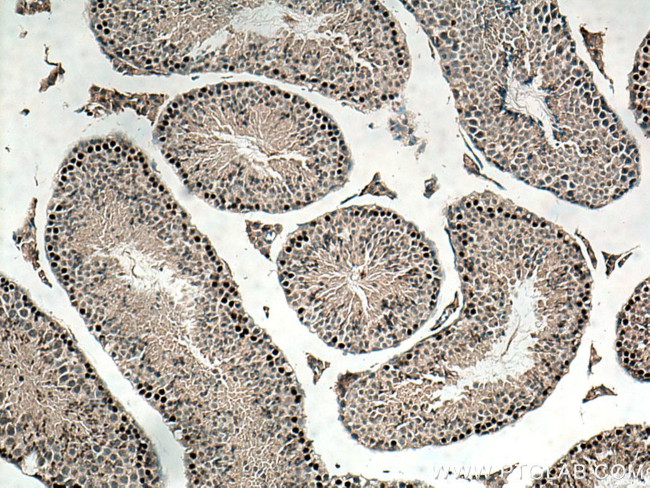 SPATA22 Antibody in Immunohistochemistry (Paraffin) (IHC (P))