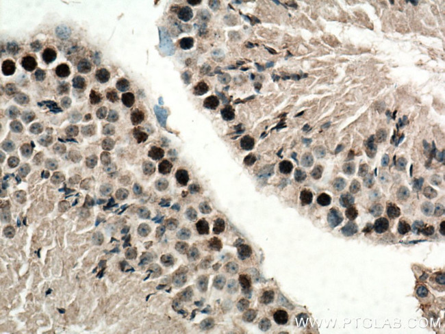 SPATA22 Antibody in Immunohistochemistry (Paraffin) (IHC (P))