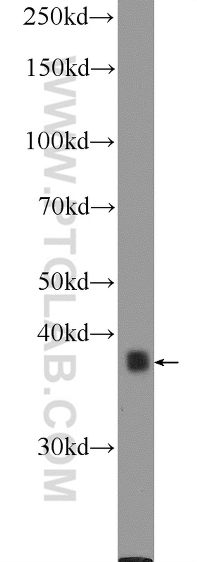 SPATA22 Antibody in Western Blot (WB)