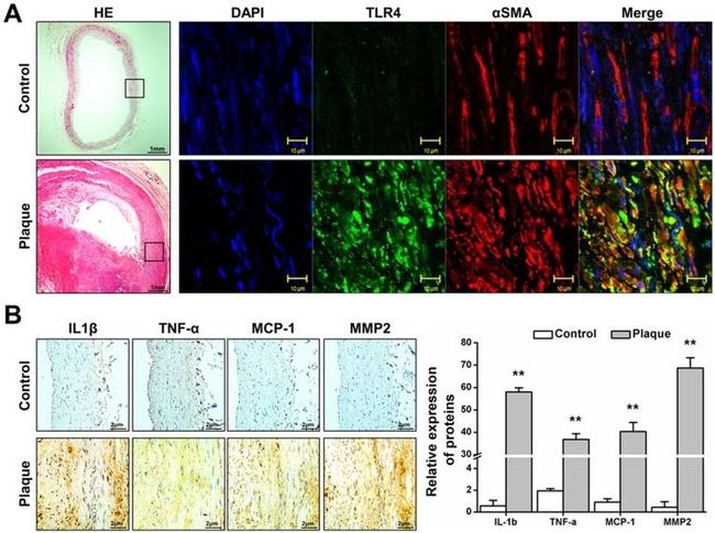 TLR4/MD-2 Complex Antibody in Immunohistochemistry (IHC)