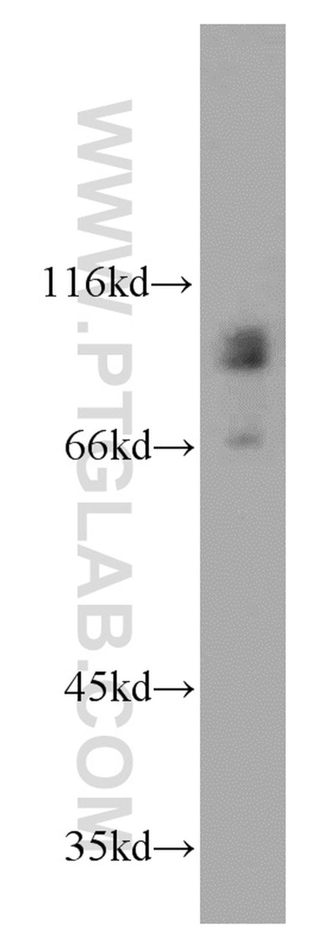 MGAT5B Antibody in Western Blot (WB)