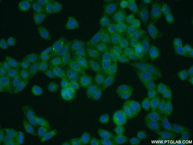 UFSP2 Antibody in Immunocytochemistry (ICC/IF)