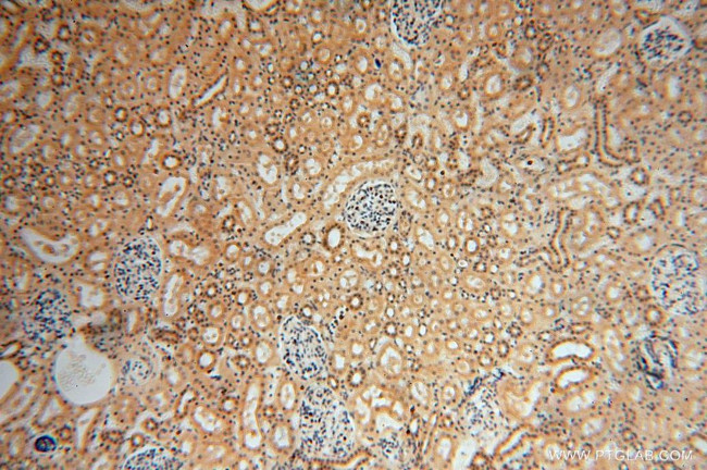 UFSP2 Antibody in Immunohistochemistry (Paraffin) (IHC (P))