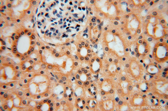 UFSP2 Antibody in Immunohistochemistry (Paraffin) (IHC (P))