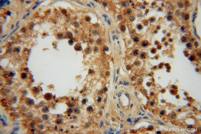 UFSP2 Antibody in Immunohistochemistry (Paraffin) (IHC (P))