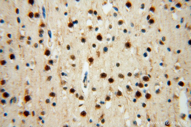 UFSP2 Antibody in Immunohistochemistry (Paraffin) (IHC (P))