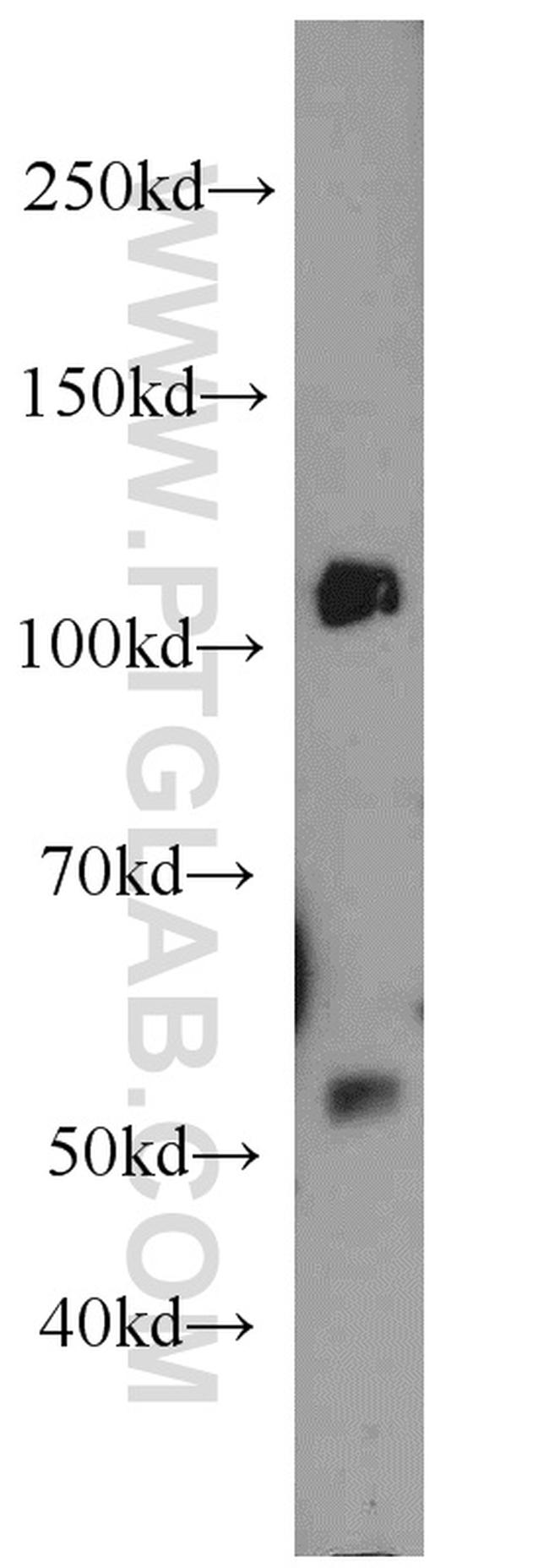 UFSP2 Antibody in Western Blot (WB)