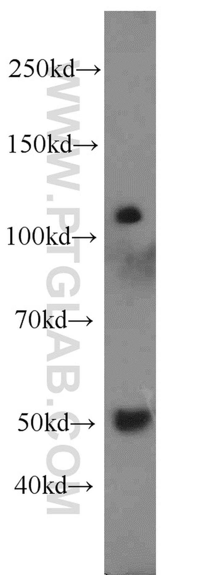 UFSP2 Antibody in Western Blot (WB)