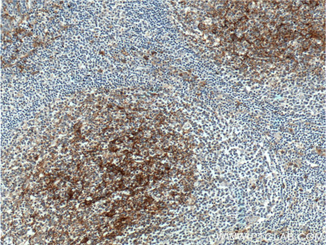 CD14 Antibody in Immunohistochemistry (Paraffin) (IHC (P))