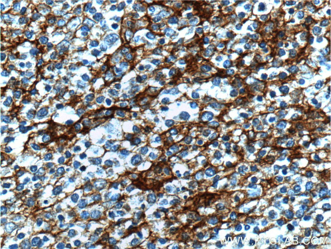 CD14 Antibody in Immunohistochemistry (Paraffin) (IHC (P))