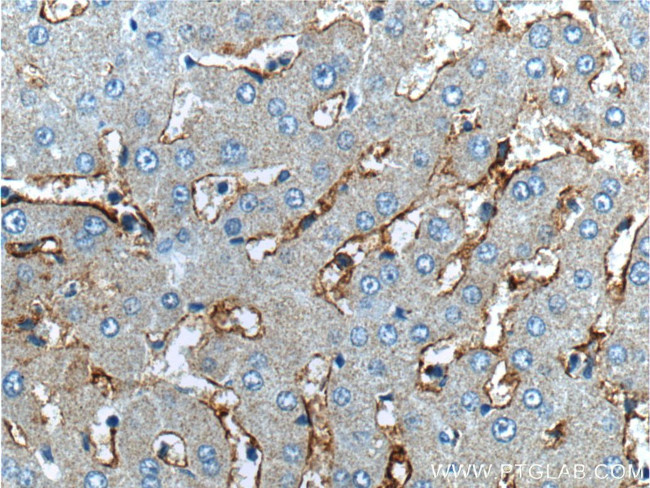 CD14 Antibody in Immunohistochemistry (Paraffin) (IHC (P))