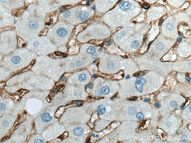 CD14 Antibody in Immunohistochemistry (Paraffin) (IHC (P))