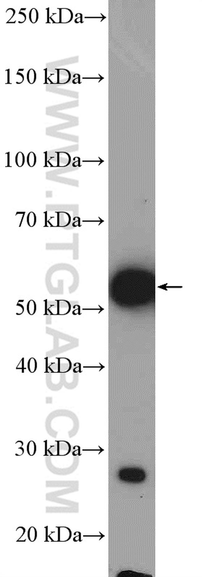 CD14 Antibody in Western Blot (WB)