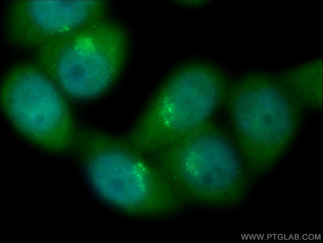 TBC1D23 Antibody in Immunocytochemistry (ICC/IF)