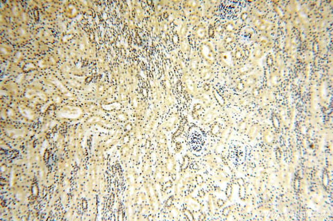 TBC1D23 Antibody in Immunohistochemistry (Paraffin) (IHC (P))