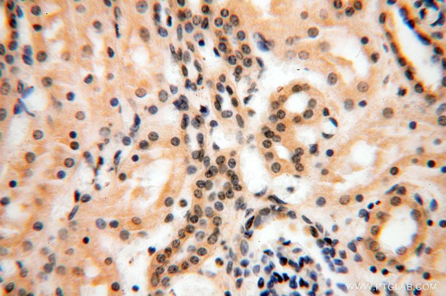 TBC1D23 Antibody in Immunohistochemistry (Paraffin) (IHC (P))