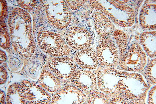 TBC1D23 Antibody in Immunohistochemistry (Paraffin) (IHC (P))