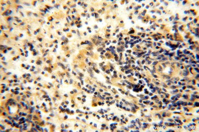 TBC1D23 Antibody in Immunohistochemistry (Paraffin) (IHC (P))