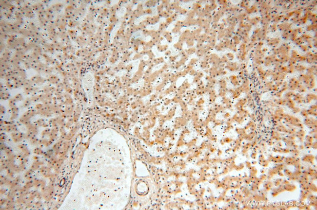 TBC1D23 Antibody in Immunohistochemistry (Paraffin) (IHC (P))