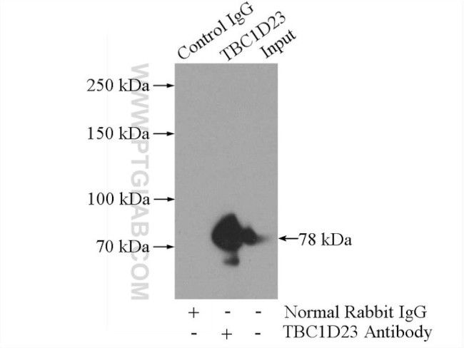 TBC1D23 Antibody in Immunoprecipitation (IP)