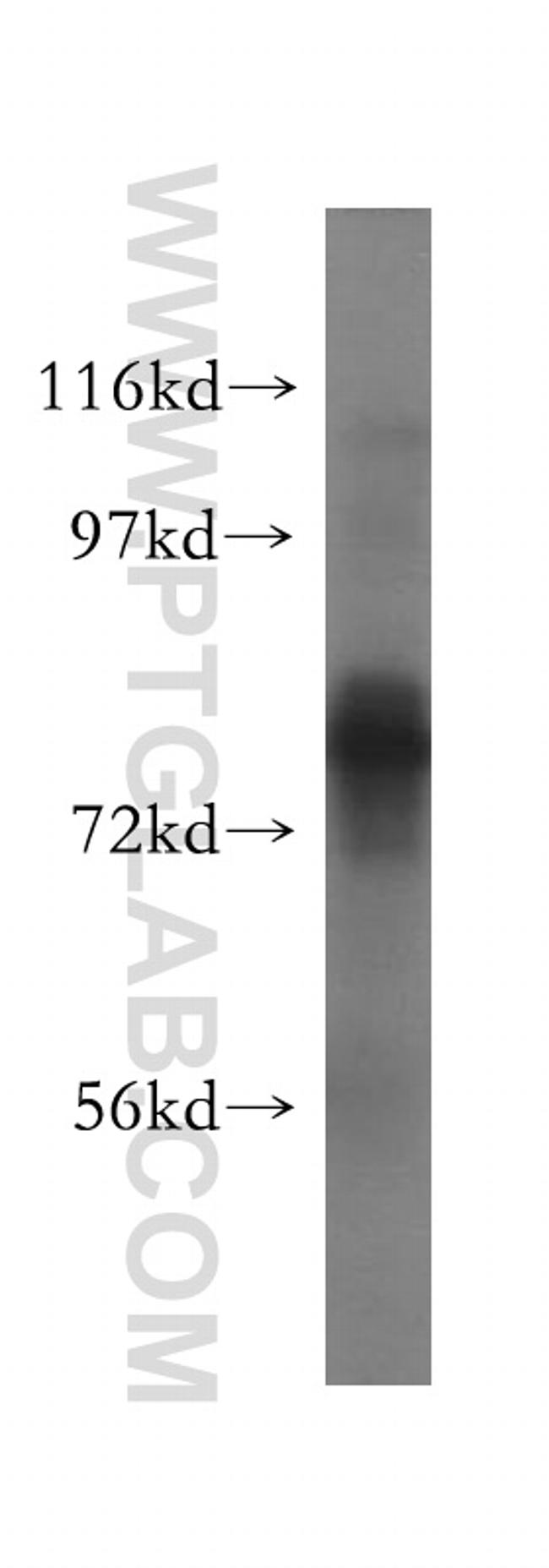 TBC1D23 Antibody in Western Blot (WB)