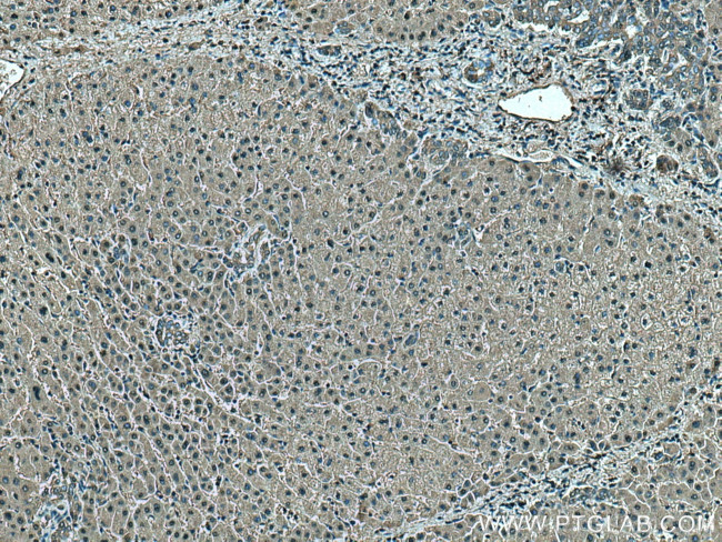 HPD Antibody in Immunohistochemistry (Paraffin) (IHC (P))