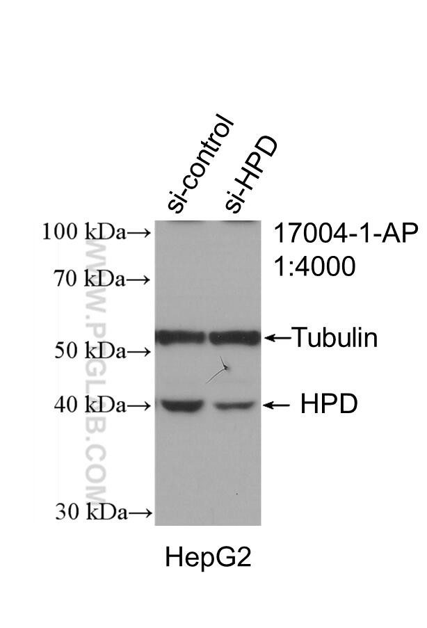 HPD Antibody in Western Blot (WB)