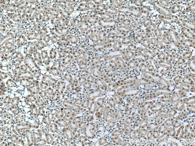 UCKL1 Antibody in Immunohistochemistry (Paraffin) (IHC (P))