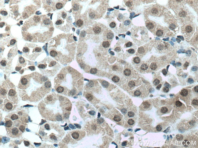 UCKL1 Antibody in Immunohistochemistry (Paraffin) (IHC (P))