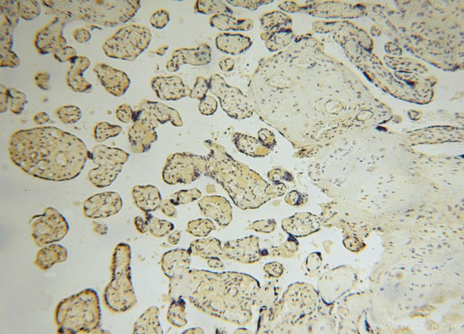 UCKL1 Antibody in Immunohistochemistry (Paraffin) (IHC (P))