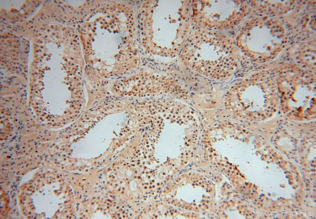 UCKL1 Antibody in Immunohistochemistry (Paraffin) (IHC (P))