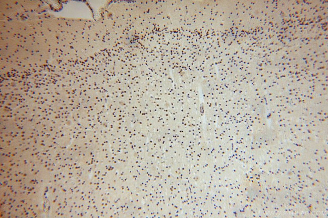 UCKL1 Antibody in Immunohistochemistry (Paraffin) (IHC (P))