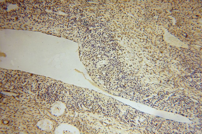 UCKL1 Antibody in Immunohistochemistry (Paraffin) (IHC (P))