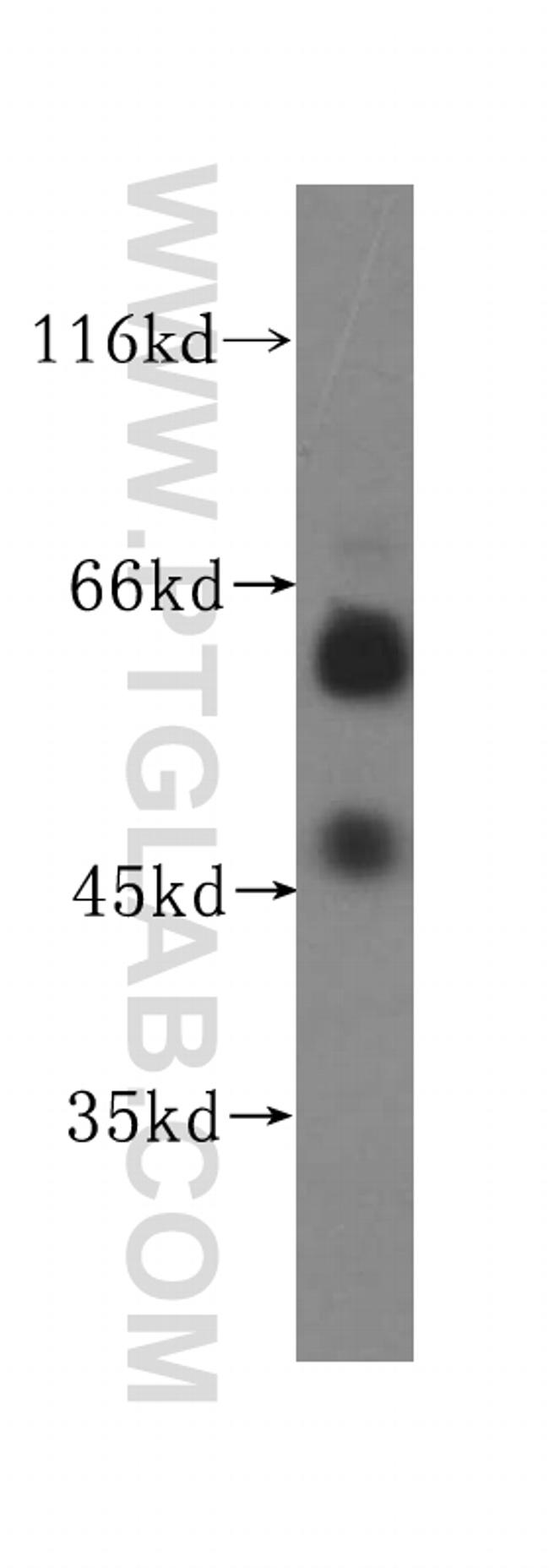 UCKL1 Antibody in Western Blot (WB)