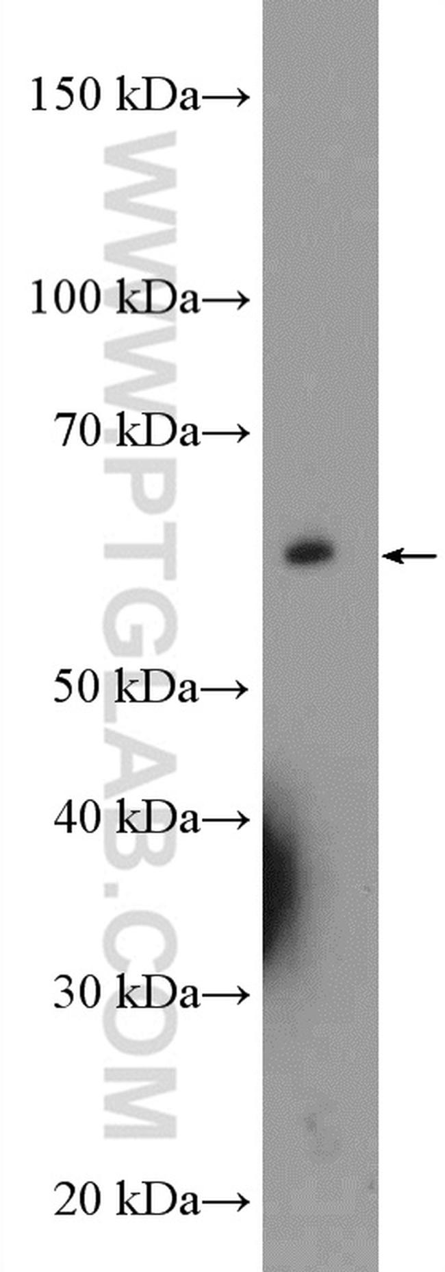 UCKL1 Antibody in Western Blot (WB)