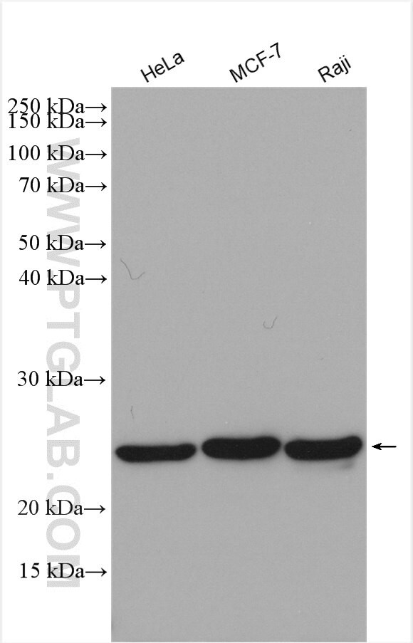 MRPS15 Antibody in Western Blot (WB)