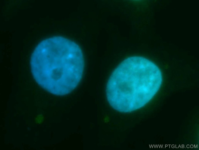 RECQL4 Antibody in Immunocytochemistry (ICC/IF)