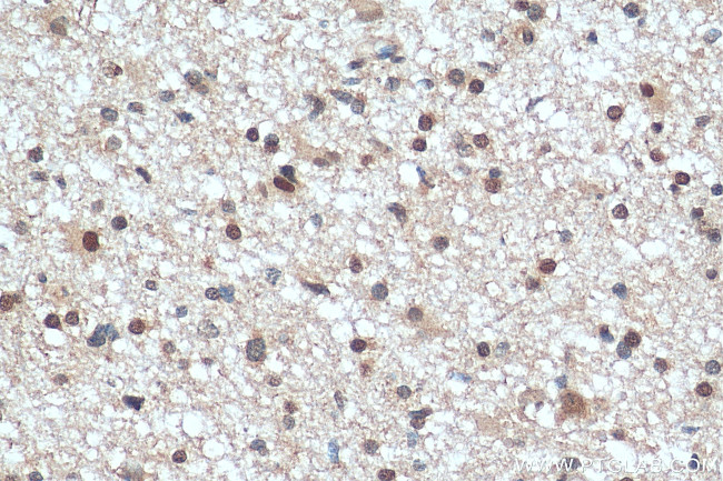 RECQL4 Antibody in Immunohistochemistry (Paraffin) (IHC (P))