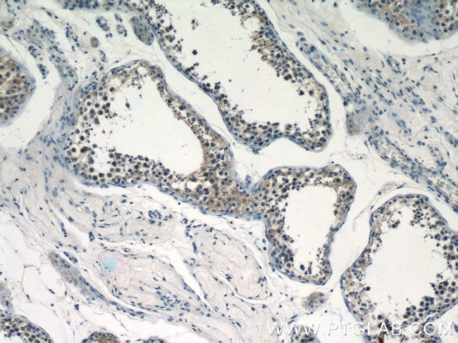 RECQL4 Antibody in Immunohistochemistry (Paraffin) (IHC (P))