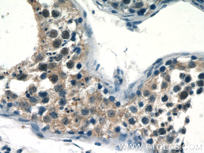 RECQL4 Antibody in Immunohistochemistry (Paraffin) (IHC (P))