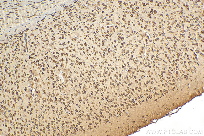 RPL10 Antibody in Immunohistochemistry (Paraffin) (IHC (P))