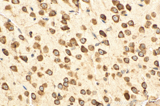 RPL10 Antibody in Immunohistochemistry (Paraffin) (IHC (P))