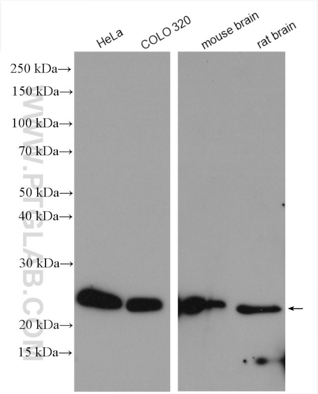 RPL10 Antibody in Western Blot (WB)