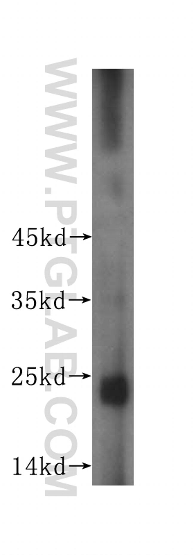 RPL10 Antibody in Western Blot (WB)