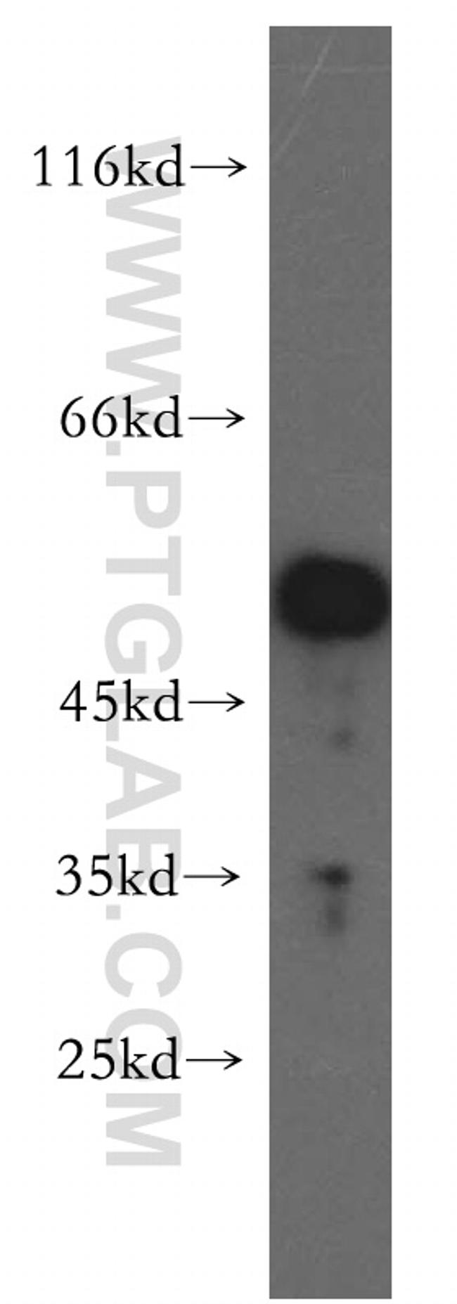 PPM1F Antibody in Western Blot (WB)