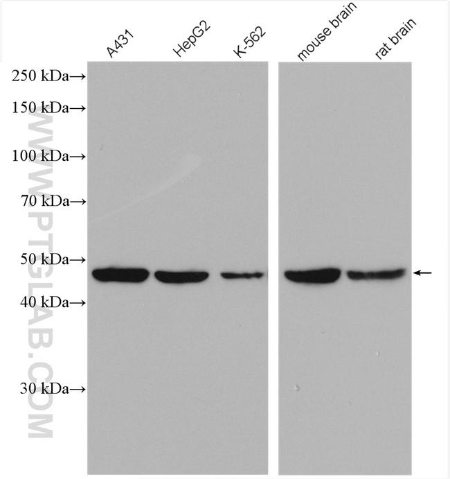 ACTR3B Antibody in Western Blot (WB)